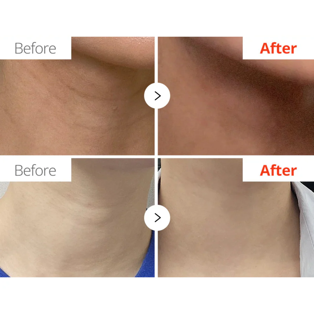 Necksphalt ECM Ceramide Neck Cream - 50 ml - Image 4